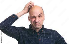 Confused bald guy scratch his head Stock Photo | Adobe Stock